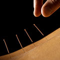 The benefits of acupuncture